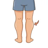 종아리