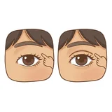 쌍꺼풀