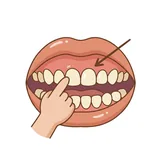 잇몸