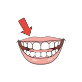 잇몸